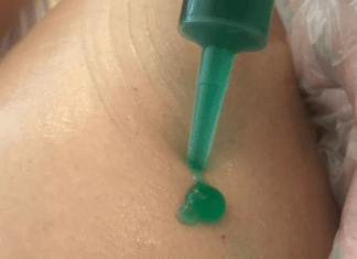 Bioslimming, un tratamiento para reducir volumen y celulitis